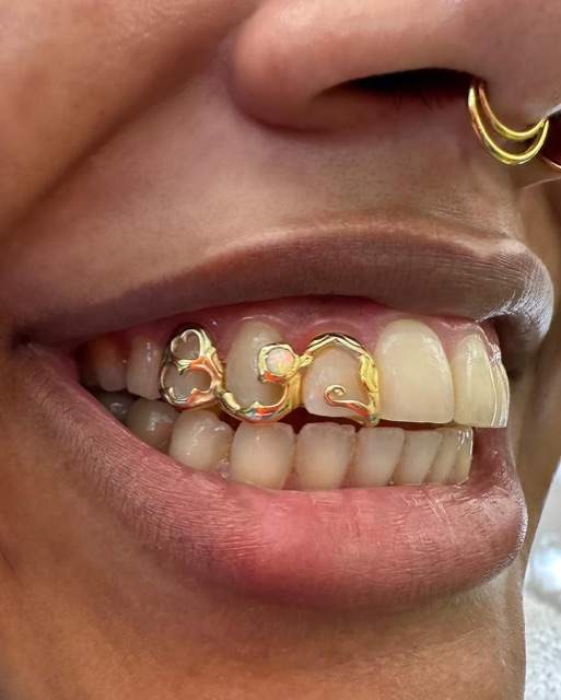 Side profile of open-work gold grillz with an opal accent across the upper teeth, paired with a gold crescent-moon nose ring