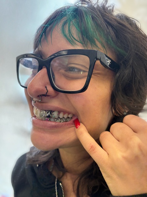 Smiling client in glasses with green-streaked hair showing tooth gems set among metal braces
