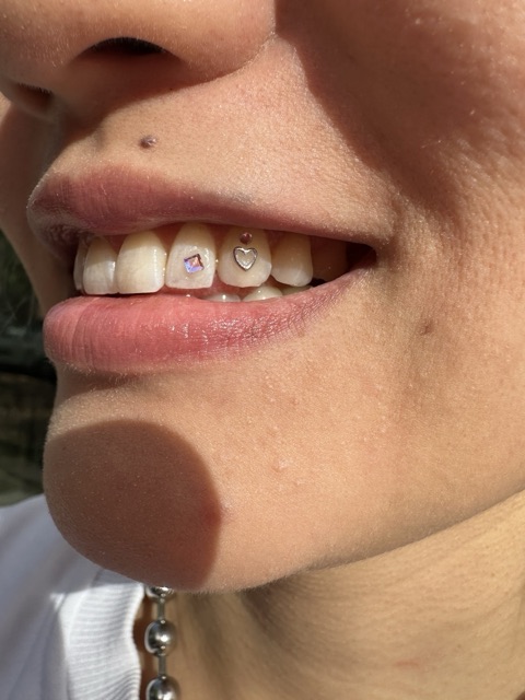 Close-up of pastel tooth gems set across the upper teeth