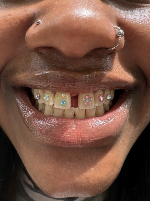 A full row of colorful crystal tooth gems across the upper teeth, worn with a septum ring and nostril piercings