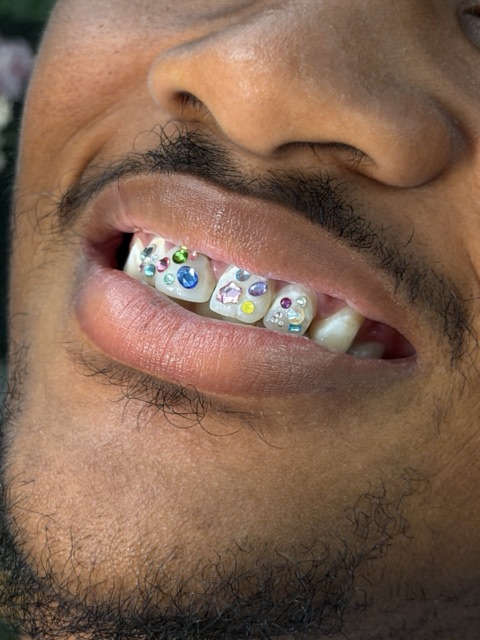 Bearded client showing a full set of multi-colored tooth gems across the upper front teeth