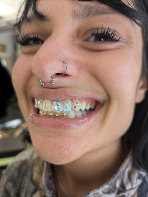 Laughing client with a septum ring showing colorful tooth gems set among braces