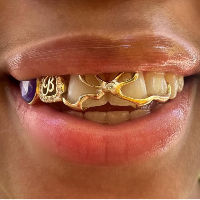 Custom gold grillz on the upper teeth with an amethyst cabochon, a diamond-accented gold initial, and an open sculpted gold front piece