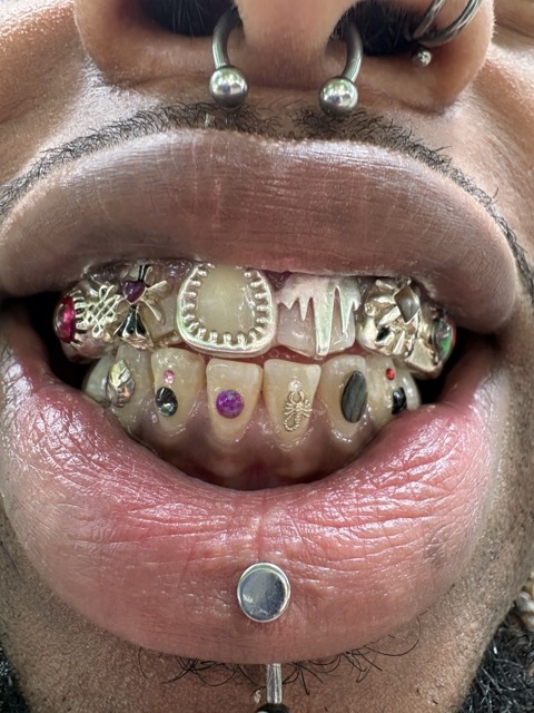 Full custom gold grillz across the upper teeth, each tooth set with a different colored gemstone, worn with paired lip piercings