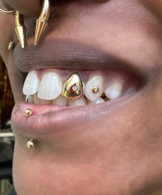 Close-up of a gold tooth cap set beside a crystal tooth gem on the upper teeth, under gold fang caps