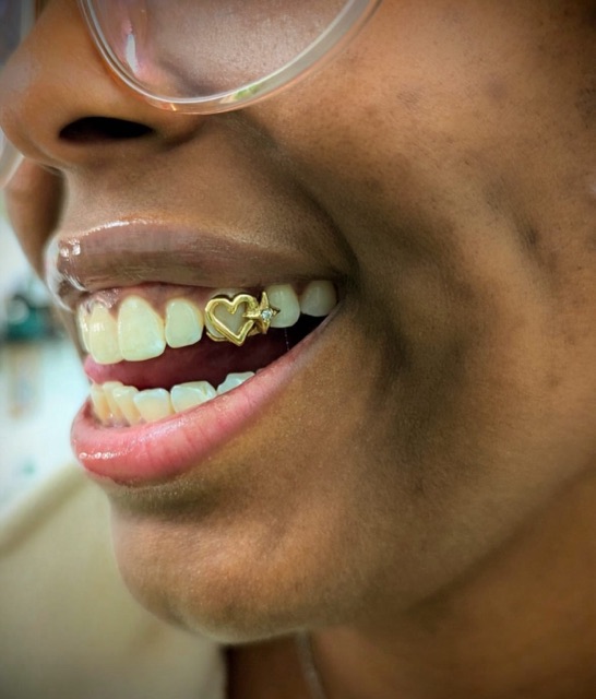 Smiling client in clear glasses showing a small gold heart charm set on an upper tooth
