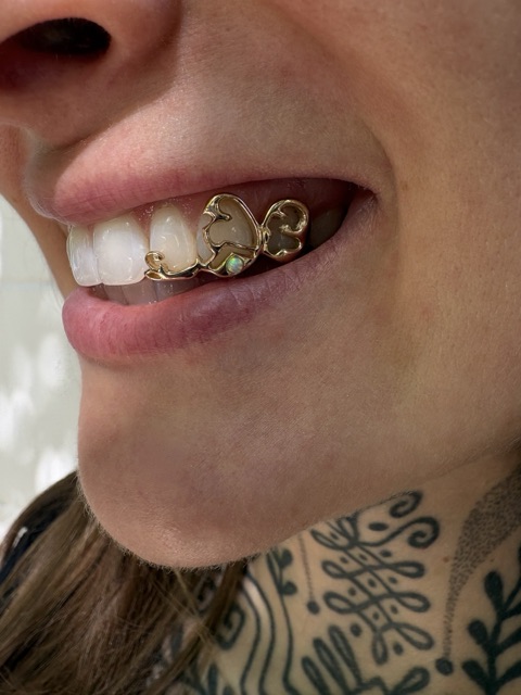 Side profile of open-work gold grillz with a bright opal accent, worn by a client with a tattooed neck