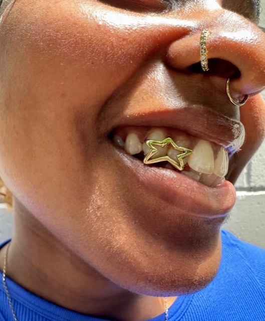Close-up of a gold star charm set on an upper tooth